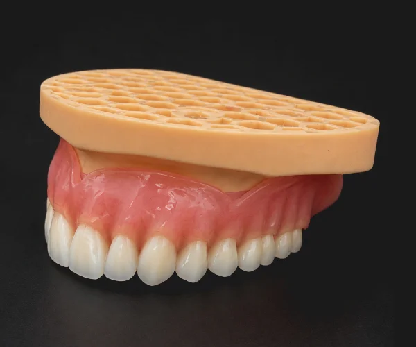 Bar retained overdenture img1