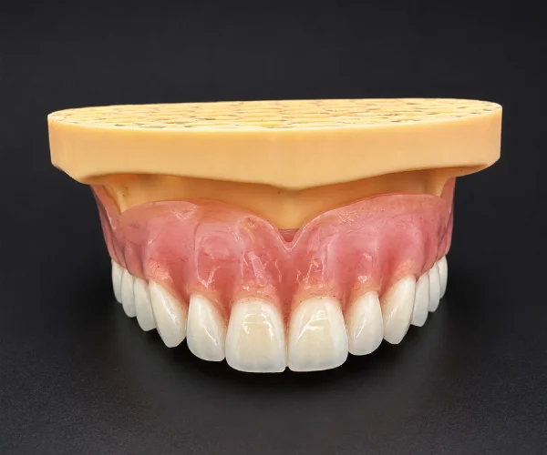 Bar retained overdenture img2