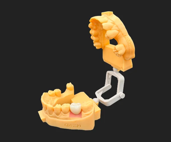Implant screw retained img2