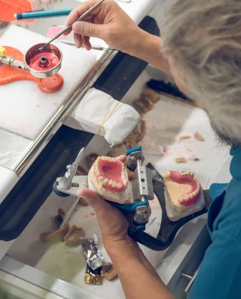 Partial & denture making