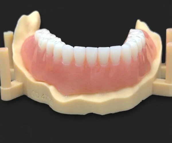 Partial dentures immediate denture over implant image4