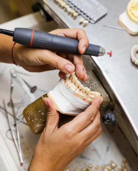 Implant making