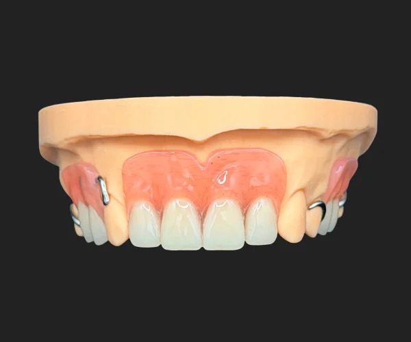 Partial and dentures acrylic partial with framework img1