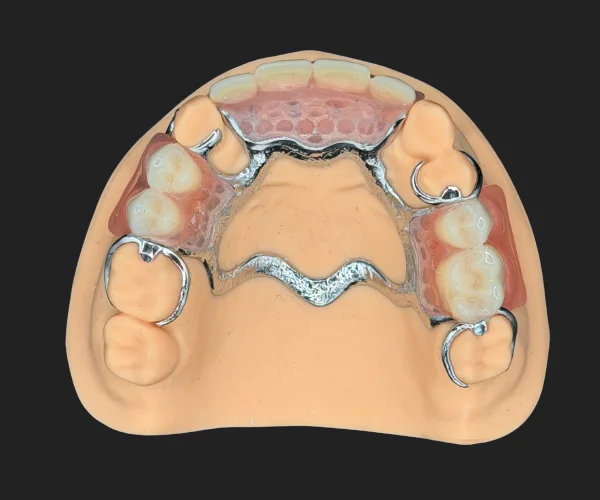 Partial and dentures acrylic partial with framework img3