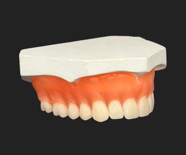 Partial and dentures traditional full denture img2