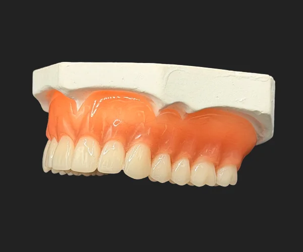 Partial and dentures traditional full denture img3