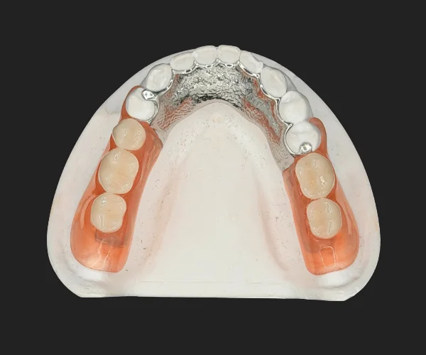 Partial and dentures valplast combo img3