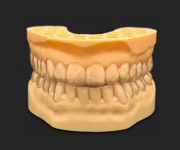 Smile aligner image1 Smile aligner image1