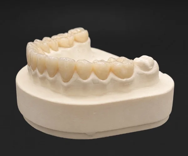 Crown and bridges - full zirconia
