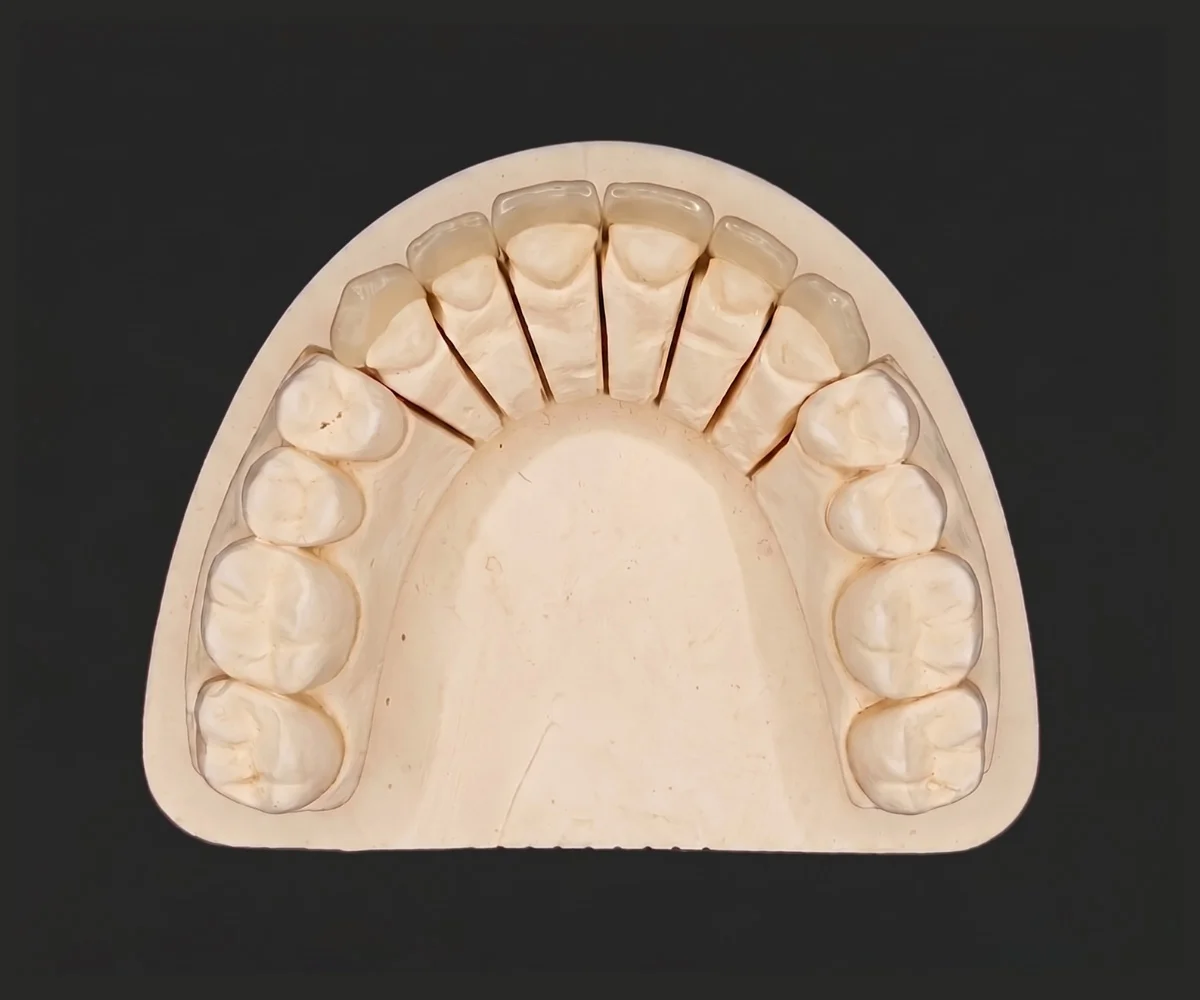 Crown and bridges hi-res image5