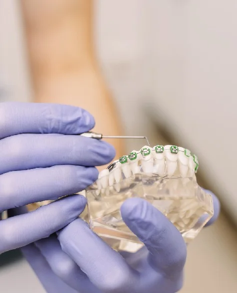 dentist shows an artificial model of the jaw with braces Dentist shows an artificial model of the jaw with braces
